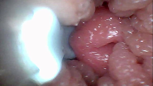 Visueller Leitfaden zur G-Punkt-Stimulation und zum Orgasmus &mdash_ Endoskop-Perspektive